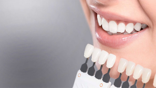 отбеливание зубов в My Smile